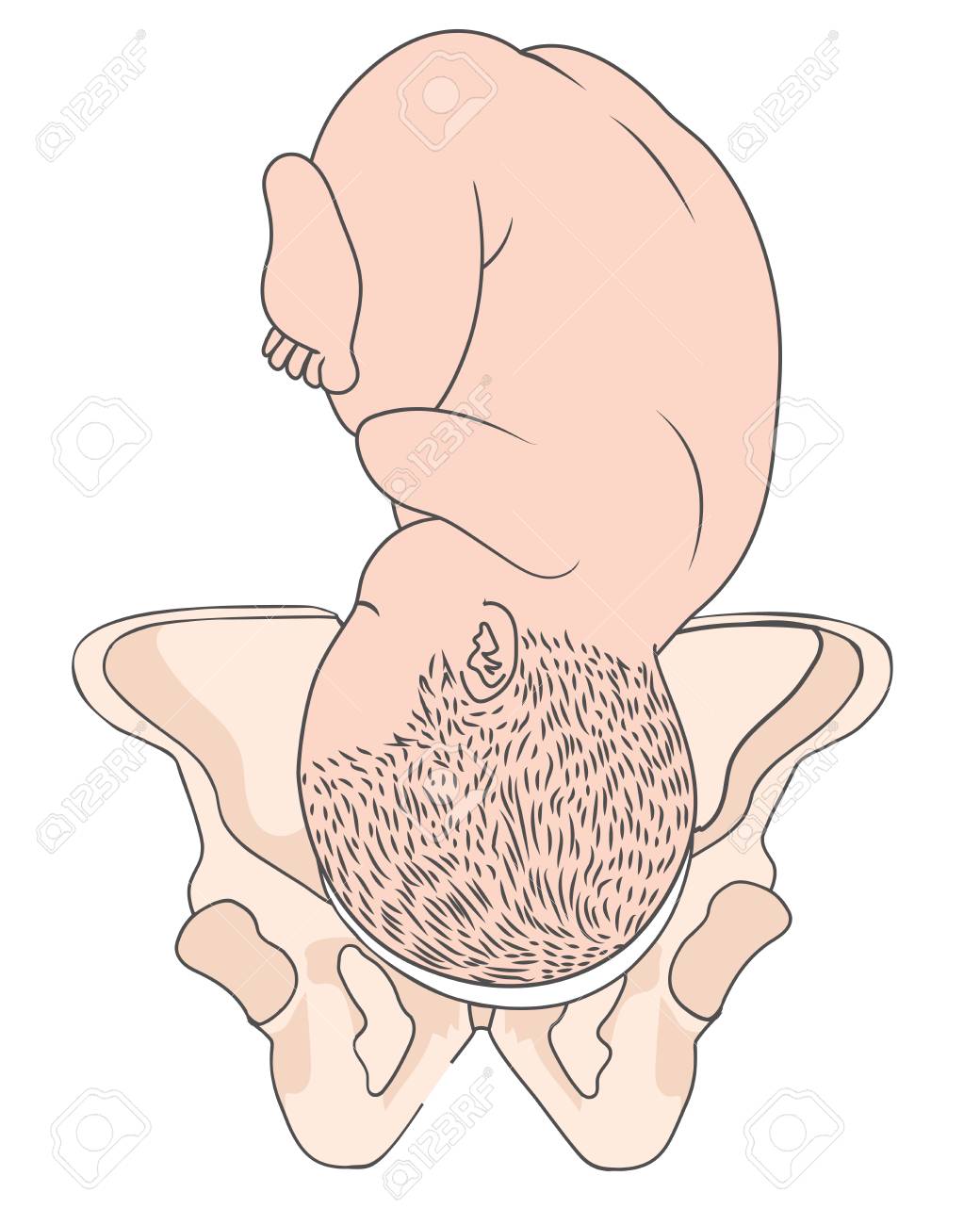 Left Occiput Anterior Loa Baby Fetal Position Pelvis Roa Right Royalty Free Cliparts Vectors And Stock Illustration Image 121868088