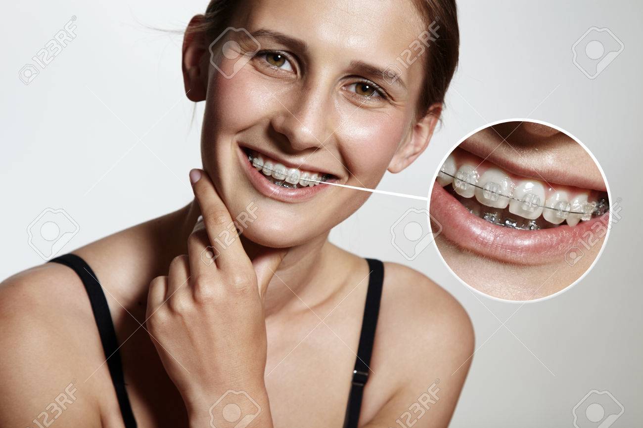 prety girl is smiling with braces and lens showing them bigger - 39569648 prety girl is smiling with braces and lens showing them bigger - 39569648
