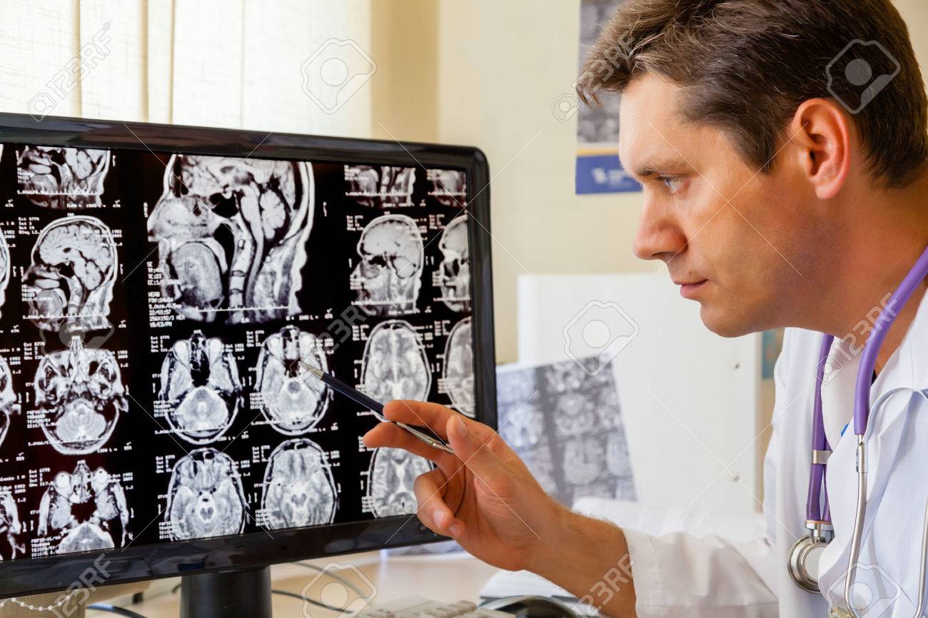 Doctor examining an MRI scan of the Brain on Monitior - 23328903 Doctor examining an MRI scan of the Brain on Monitior - 23328903