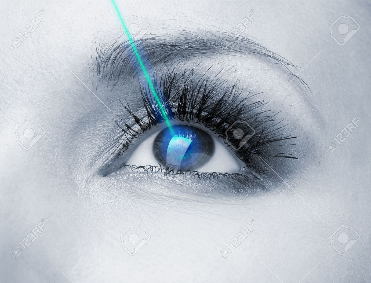Laser vision correction. Woman's eye. - 27096217 Laser vision correction. Woman's eye. - 27096217