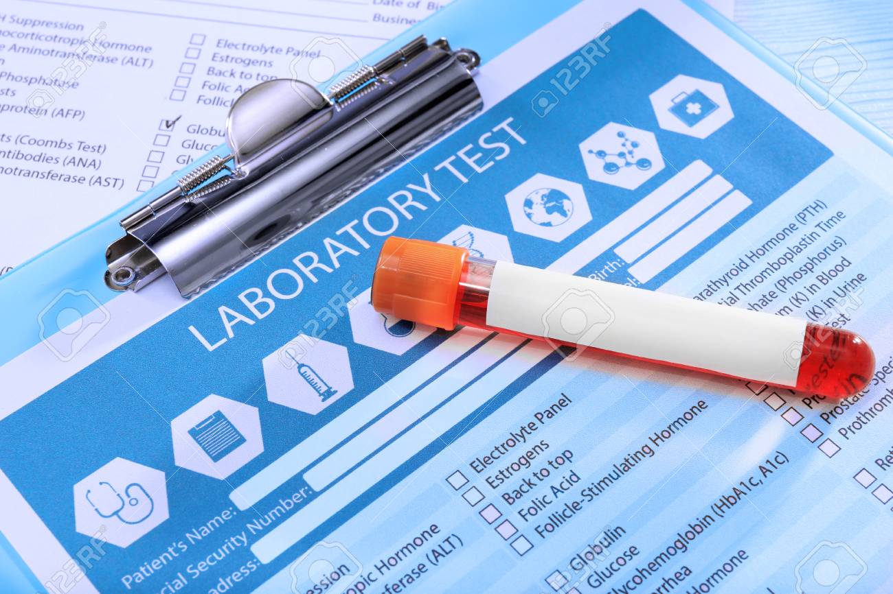 医療報告書の血液サンプル の写真素材 画像素材 Image 96041889