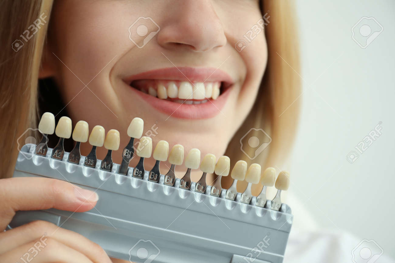 Woman matching teeth color with palette on white background, closeup. Cosmetic dentistry - 155447627 Woman matching teeth color with palette on white background, closeup. Cosmetic dentistry - 155447627