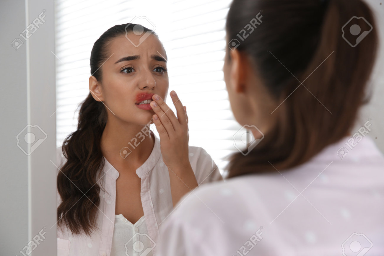 Young woman with herpes touching lips in front of mirror at home - 166814369 Young woman with herpes touching lips in front of mirror at home - 166814369