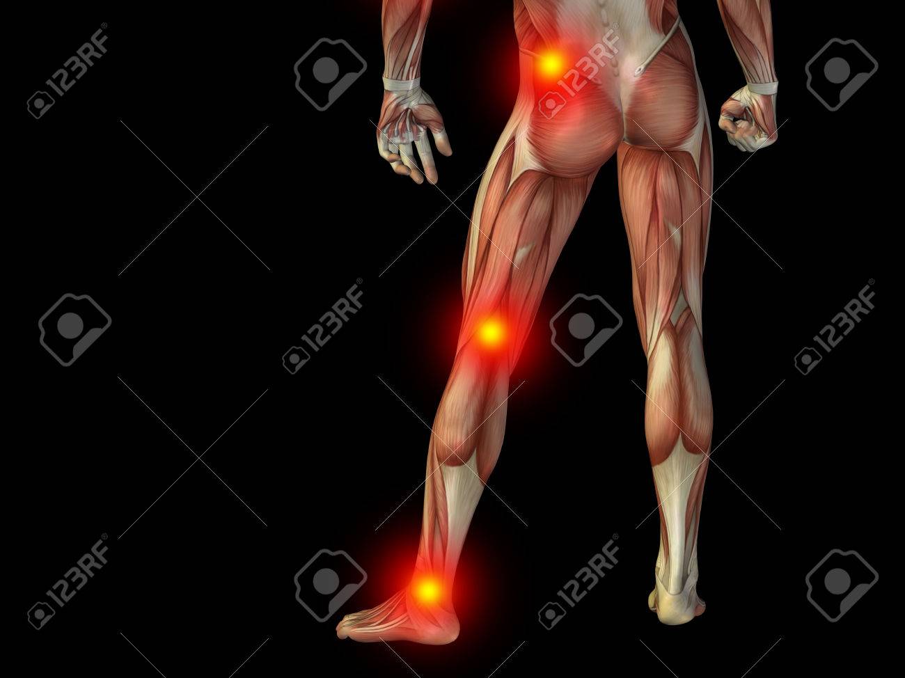 Conceptual human body anatomy articular pain on isolated on black background - 37633370 Conceptual human body anatomy articular pain on isolated on black background - 37633370