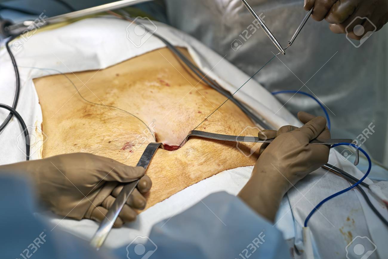 etiam-dictum-ipsum-a-felis