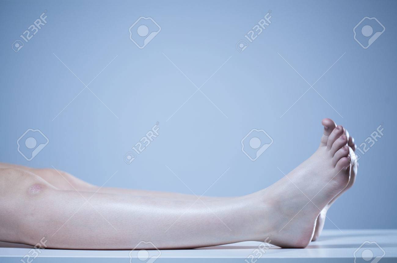 死体安置所の死体の横の眺め の写真素材 画像素材 Image