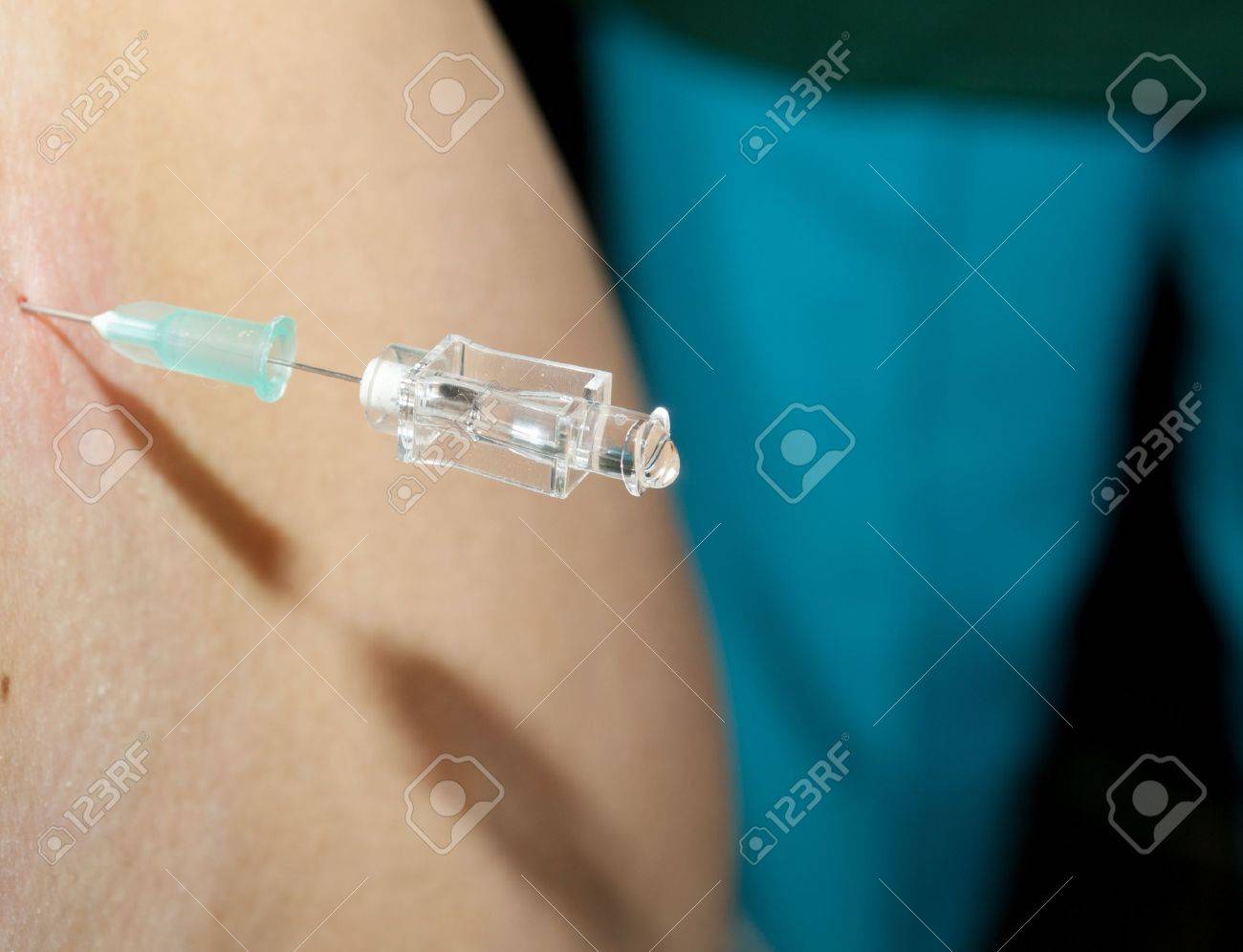 帝王切開での準備で脊髄くも膜下麻酔注射 の写真素材 画像素材 Image 2605