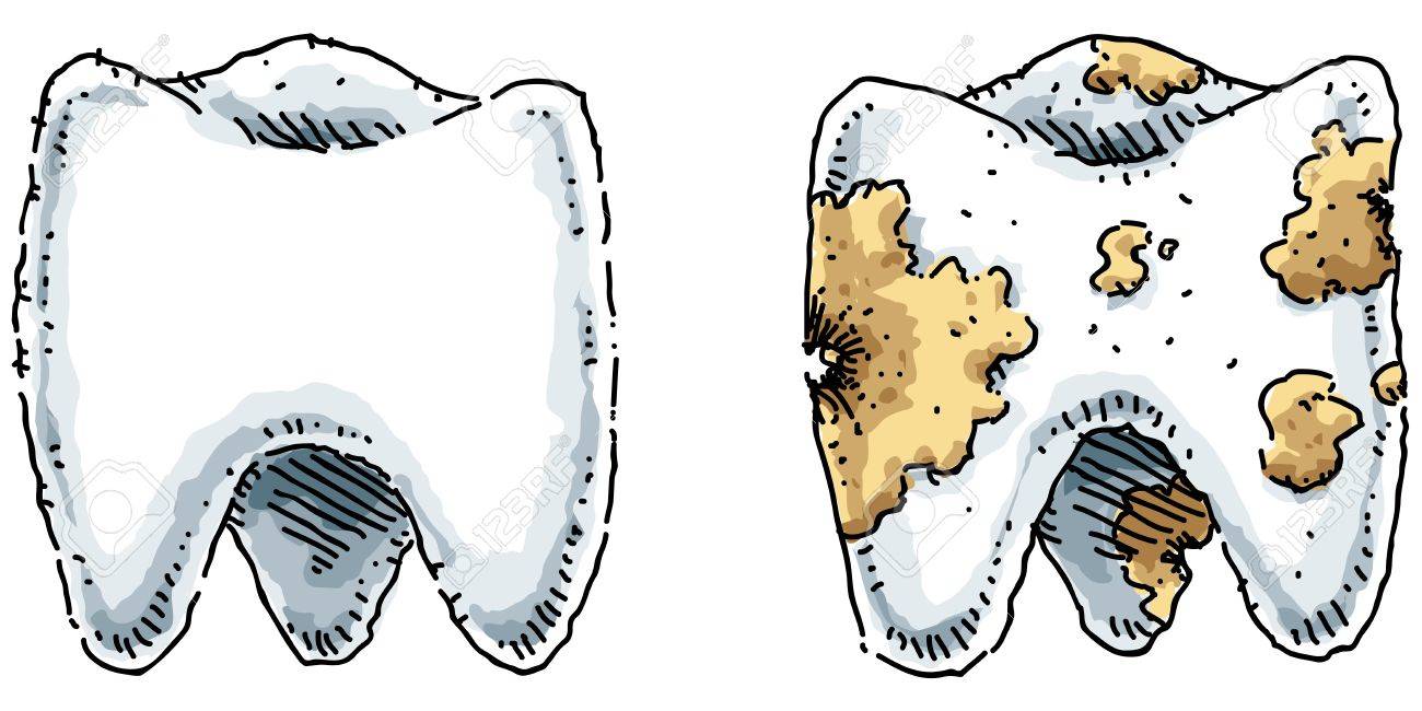 Грязные зубы картинки для детей