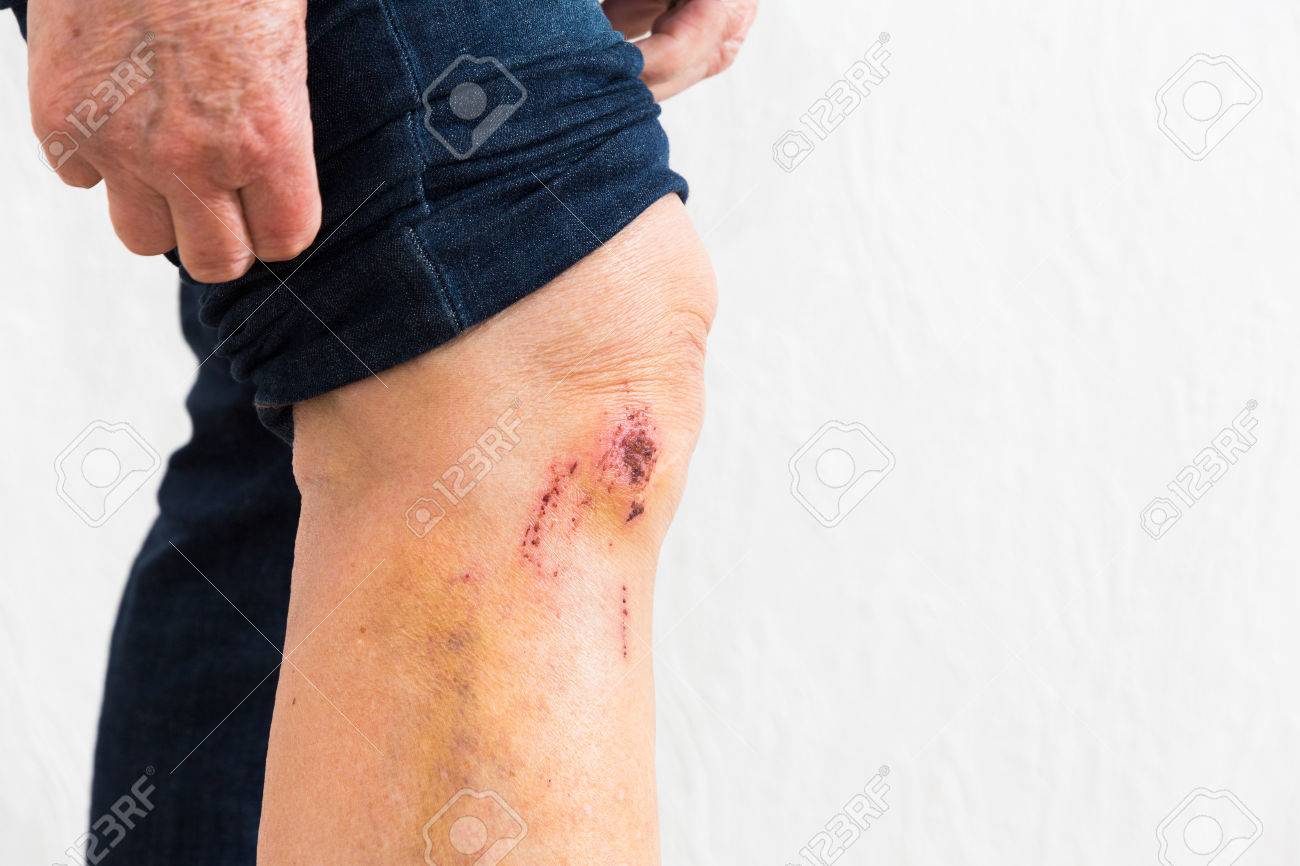 etiam-dictum-ipsum-a-felis