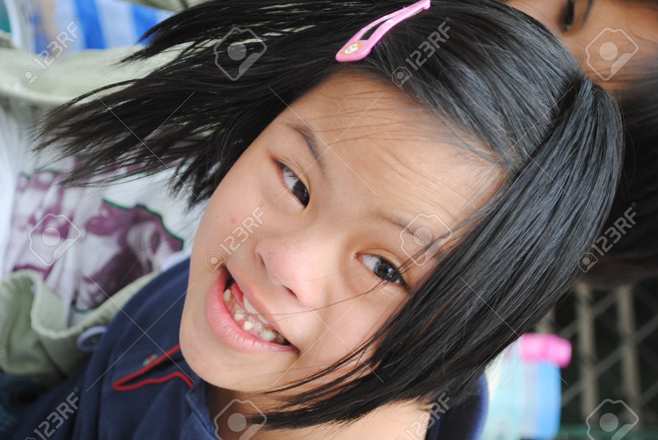 Ubonratchathani Thailand 19 Januar Ein Unbekannter Down Syndrom Madchen Lachelt Die Besucher In Ihrem Haus Am 19 Januar 2010 In Ubonratchathani Thailand Lizenzfreie Fotos Bilder Und Stock Fotografie Image 21475188