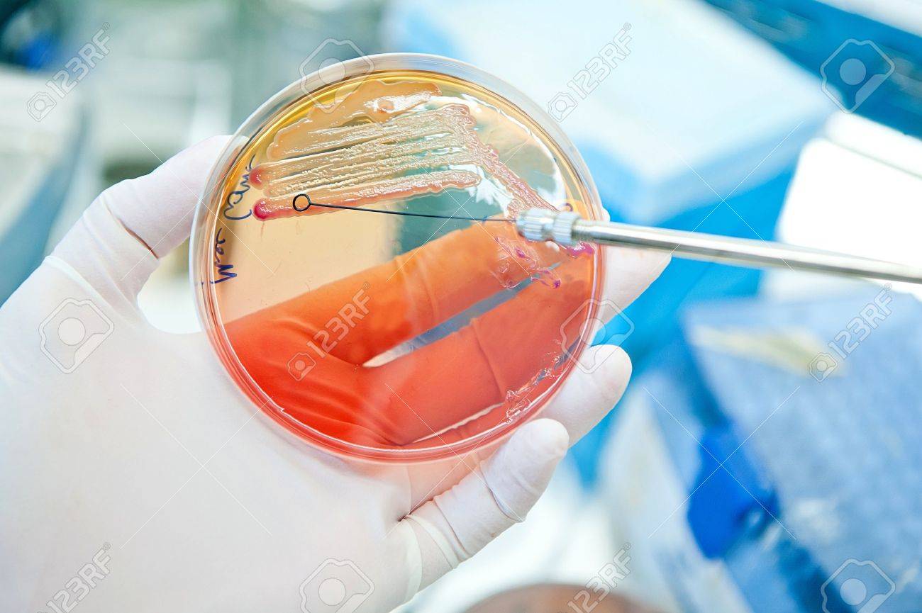 escherichia coli bacteria at petri plate Inoculating loop for spreading bacteria - 21774858 escherichia coli bacteria at petri plate Inoculating loop for spreading bacteria - 21774858