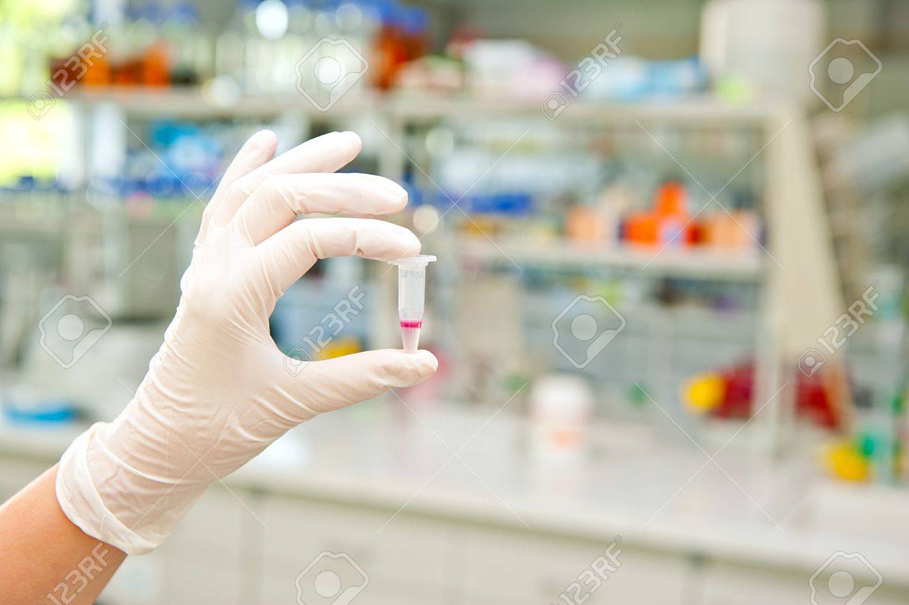 Hand in glove holding tube with biochemistry test for indole detection - 31038164 Hand in glove holding tube with biochemistry test for indole detection - 31038164