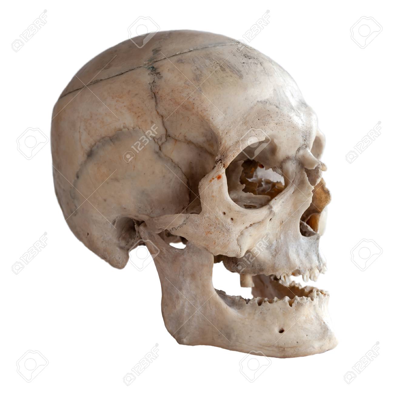 Anatomical Real Human Skull, Closeup. Angle View Three Quarters. Isolated  On White Background And Clipping Path. Фотография, картинки, изображения и  сток-фотография без роялти. Image 113062030