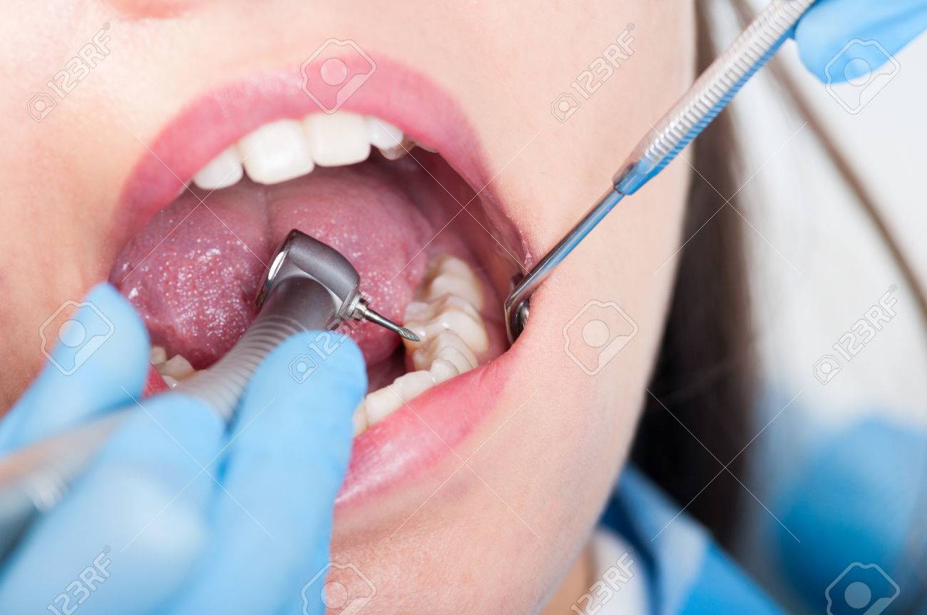 close up of dental drill use for patient teeth in dentistry office