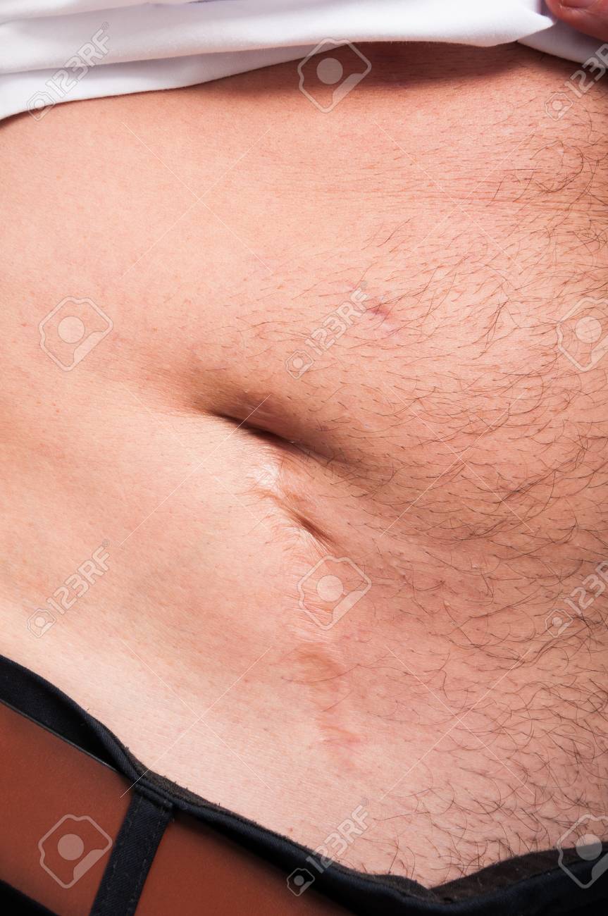 Narbe am bauch pflegen