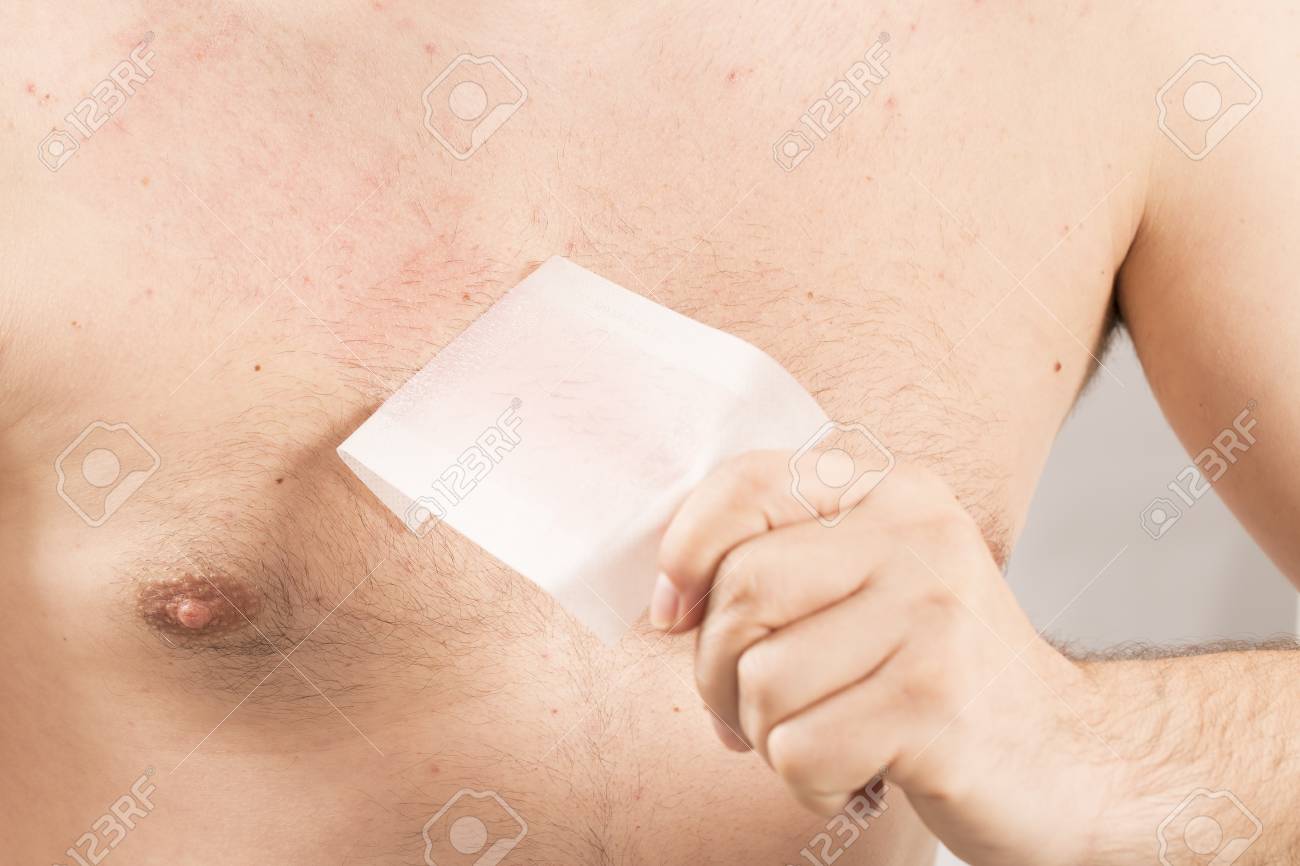 Waxing Man Torso Cosmetic Depilation Epilate Hair France Stock