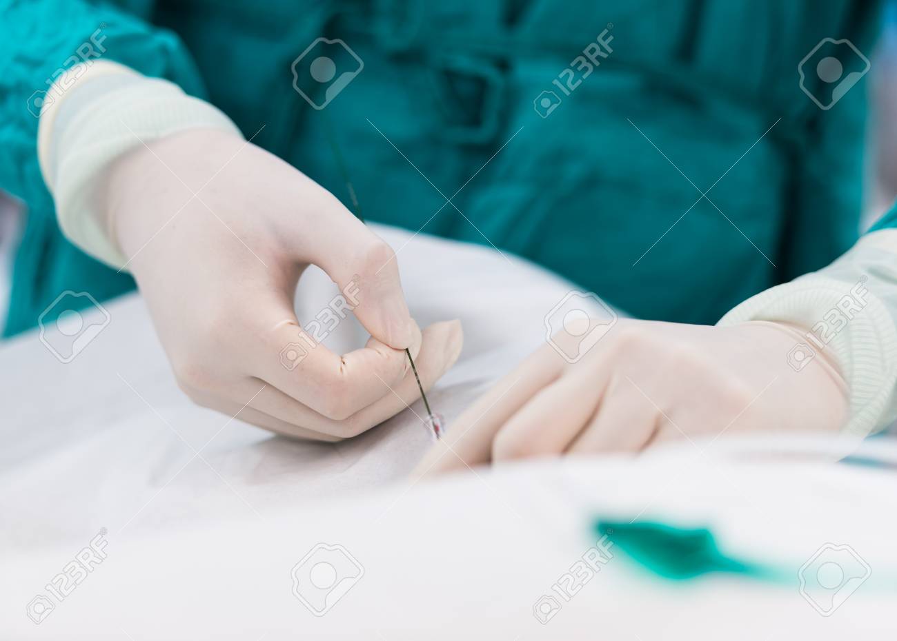 etiam-dictum-ipsum-a-felis