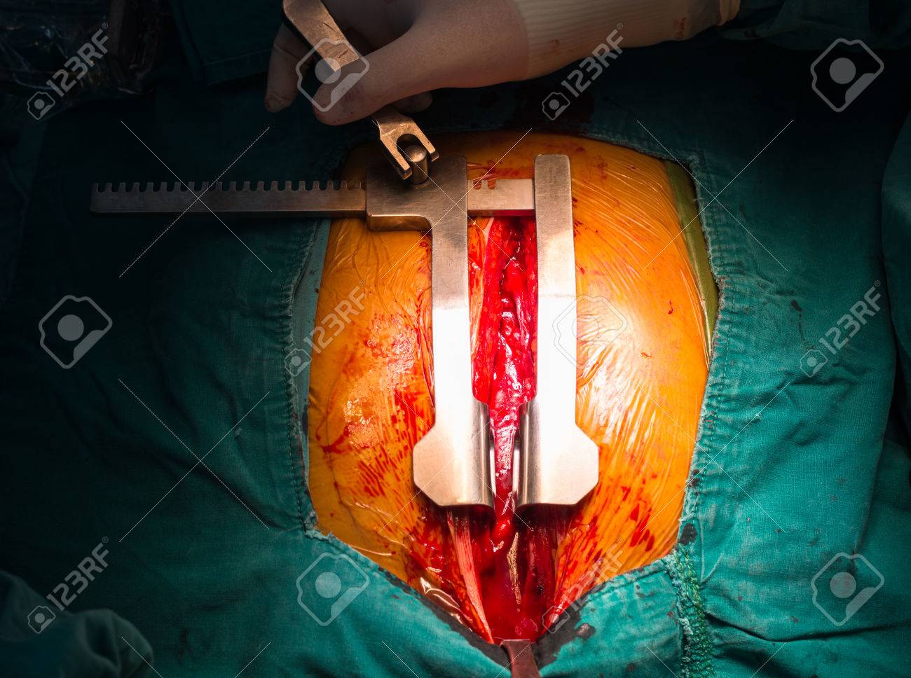 etiam-dictum-ipsum-a-felis