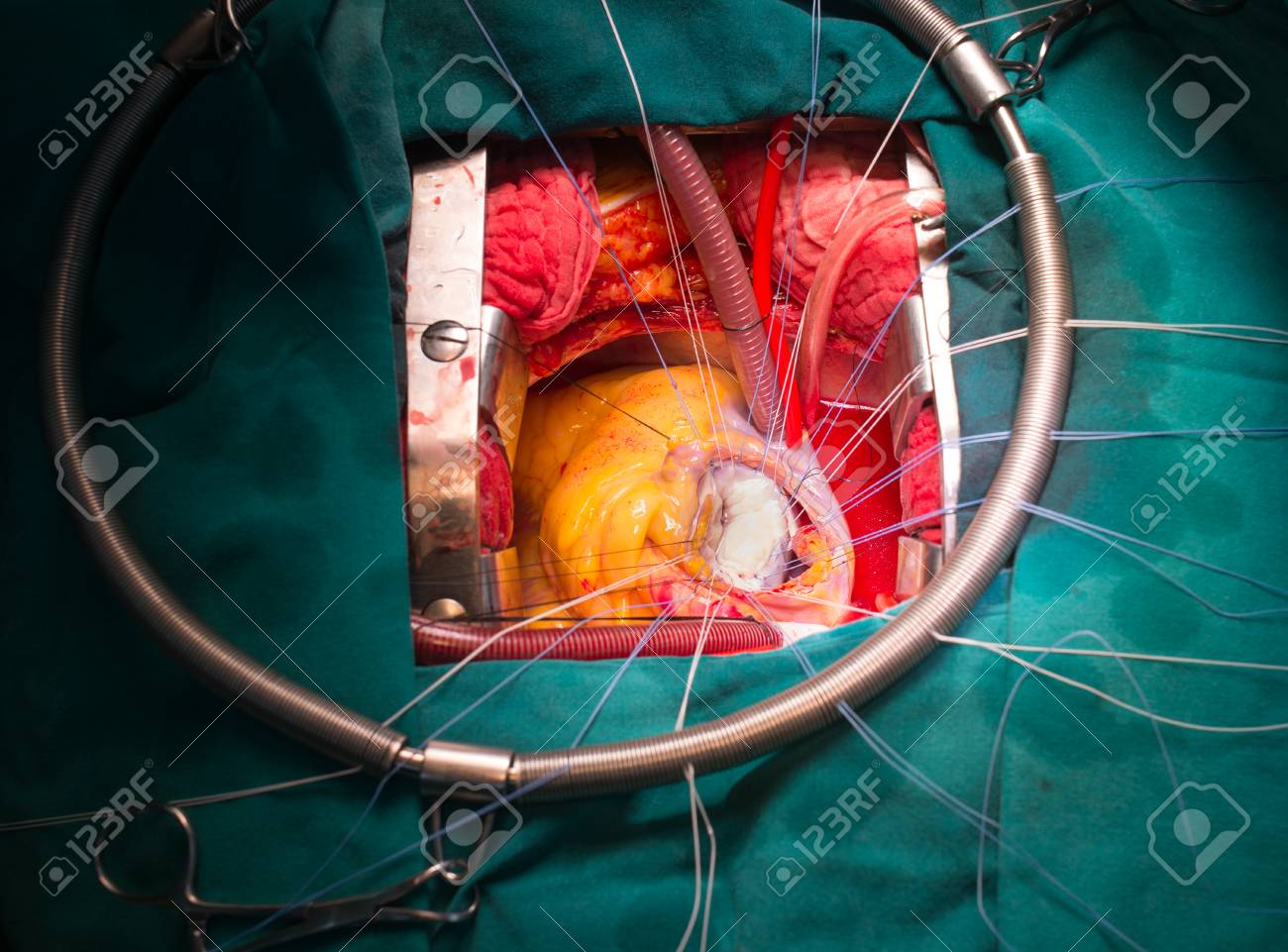 etiam-dictum-ipsum-a-felis