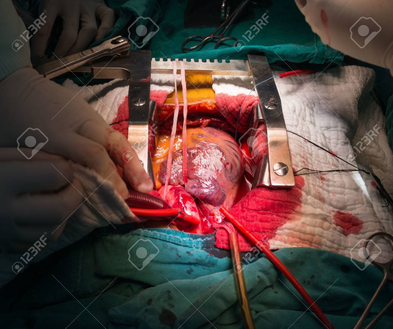 etiam-dictum-ipsum-a-felis