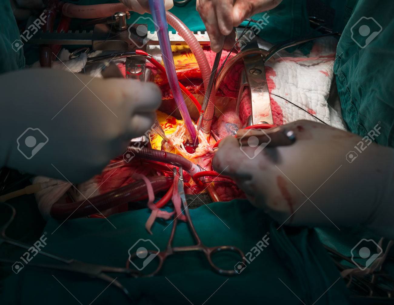 etiam-dictum-ipsum-a-felis