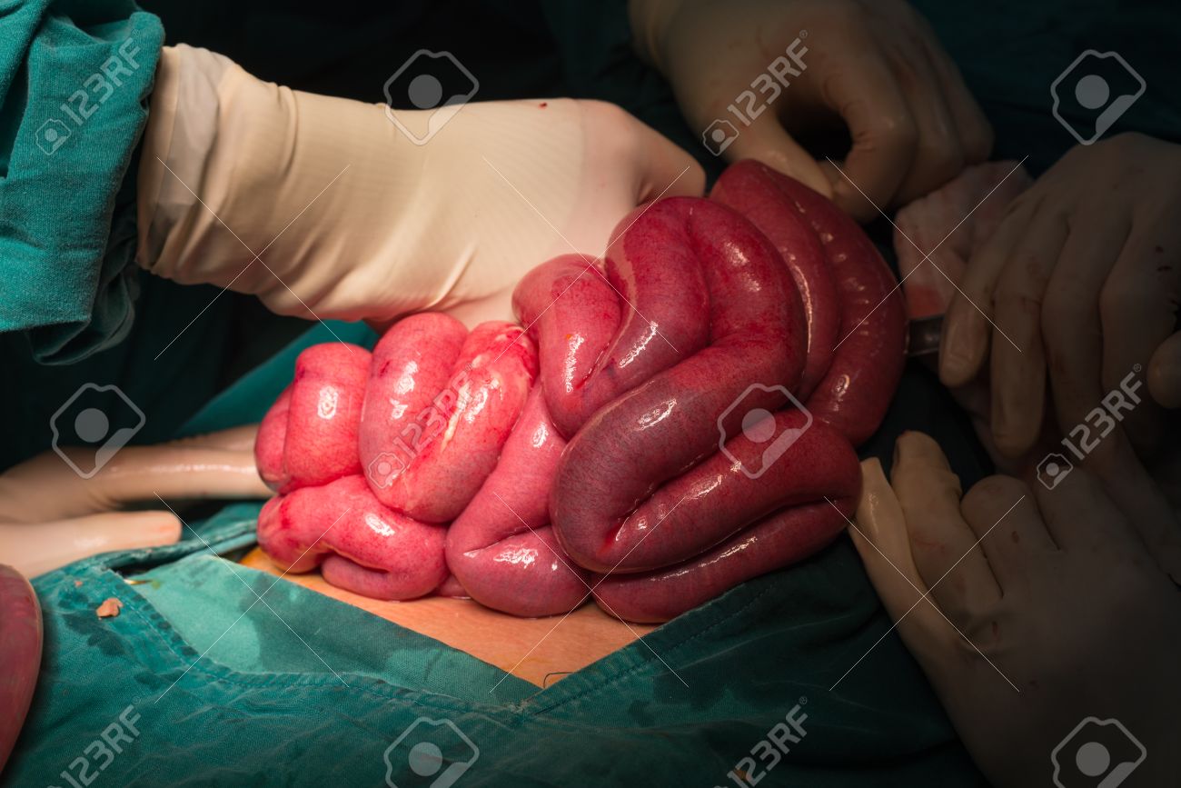 etiam-dictum-ipsum-a-felis