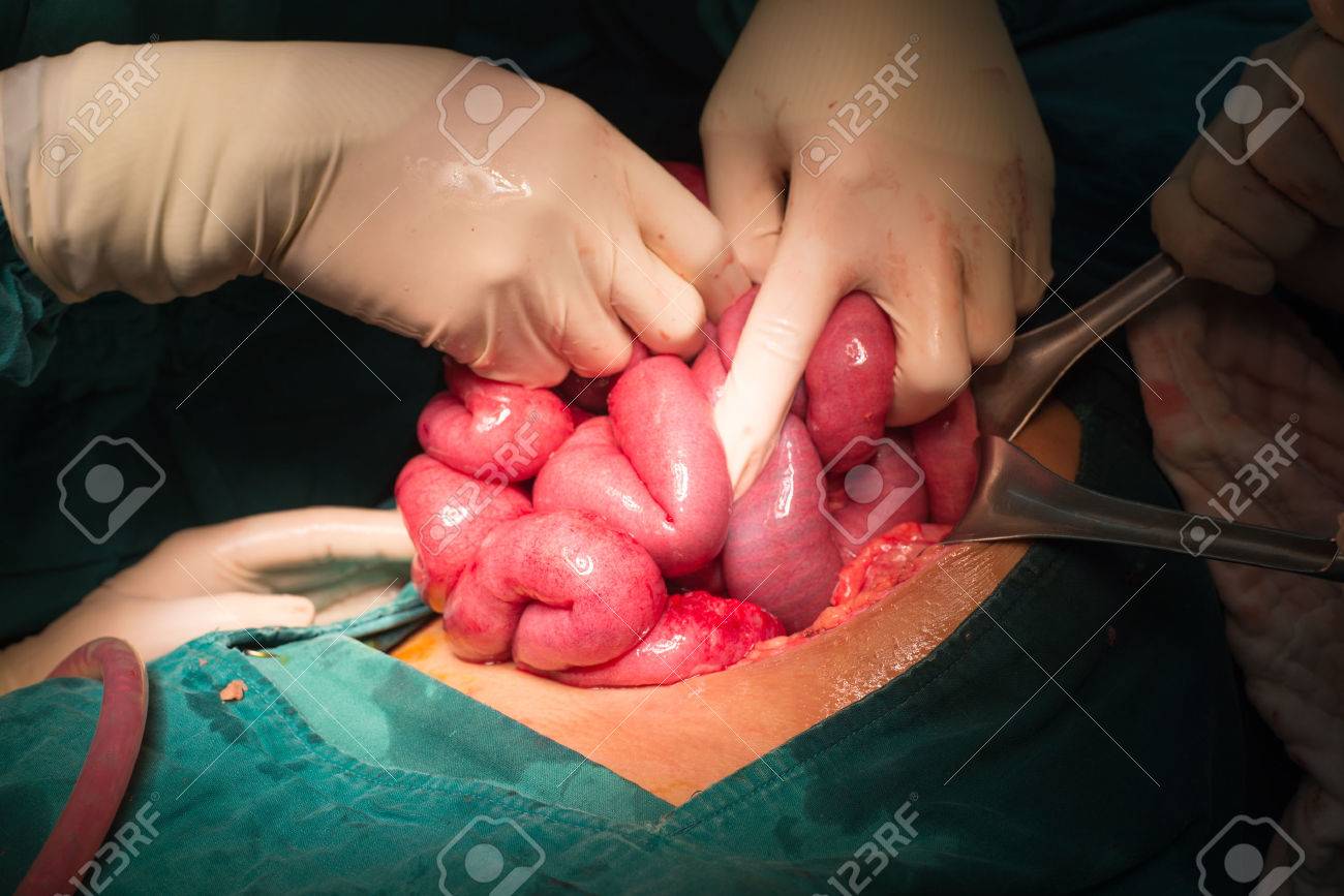 小腸 の写真素材 画像素材 Image