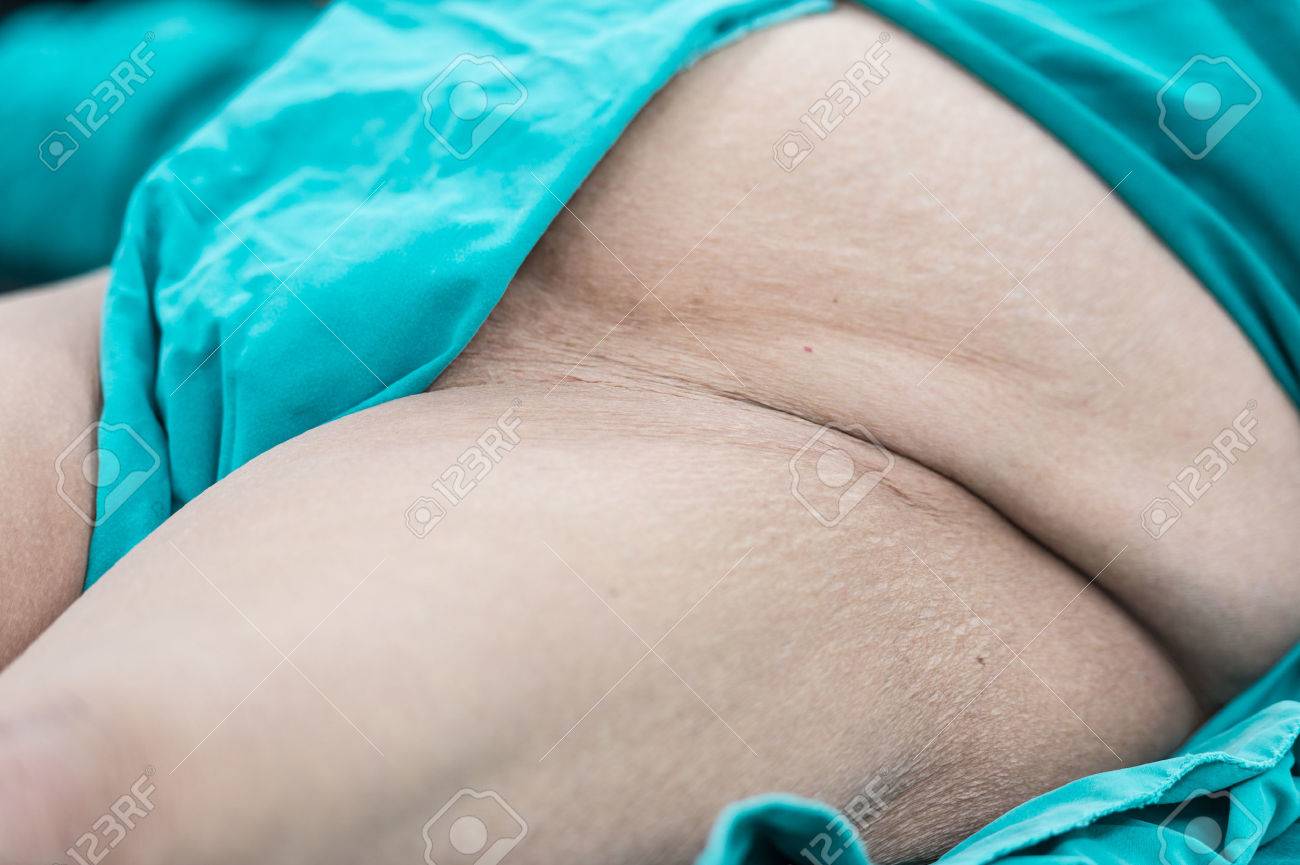 etiam-dictum-ipsum-a-felis