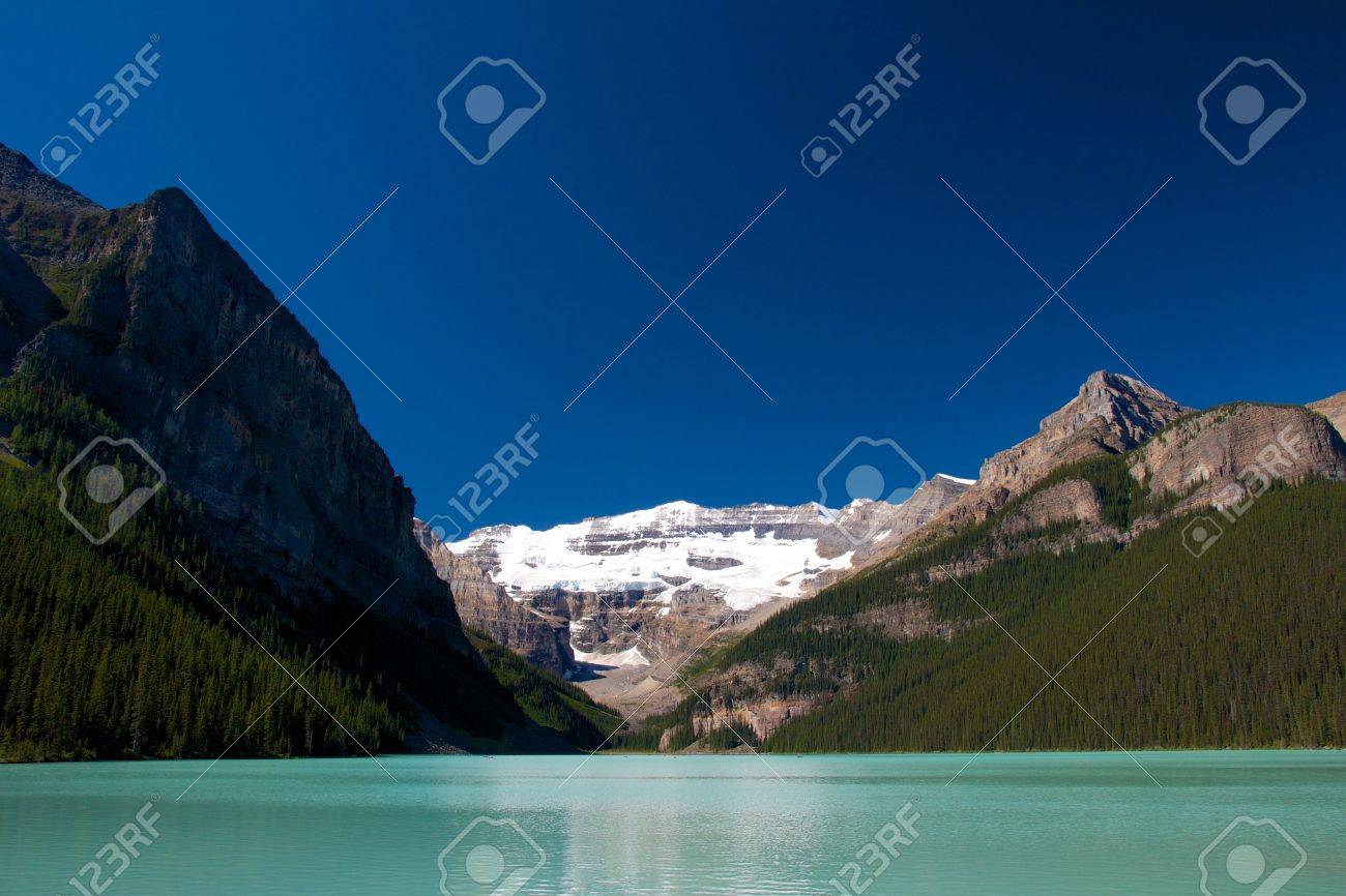 Quiet scenery of Lake Louise under a clear blue sky - 15320755 Quiet scenery of Lake Louise under a clear blue sky - 15320755