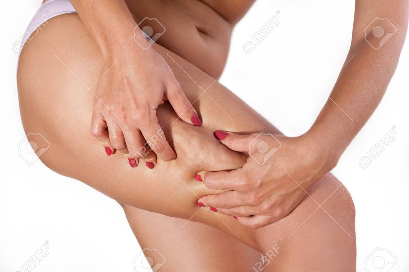 太ももの上の女性セルライトは 彼女の手で絞った の写真素材 画像素材 Image