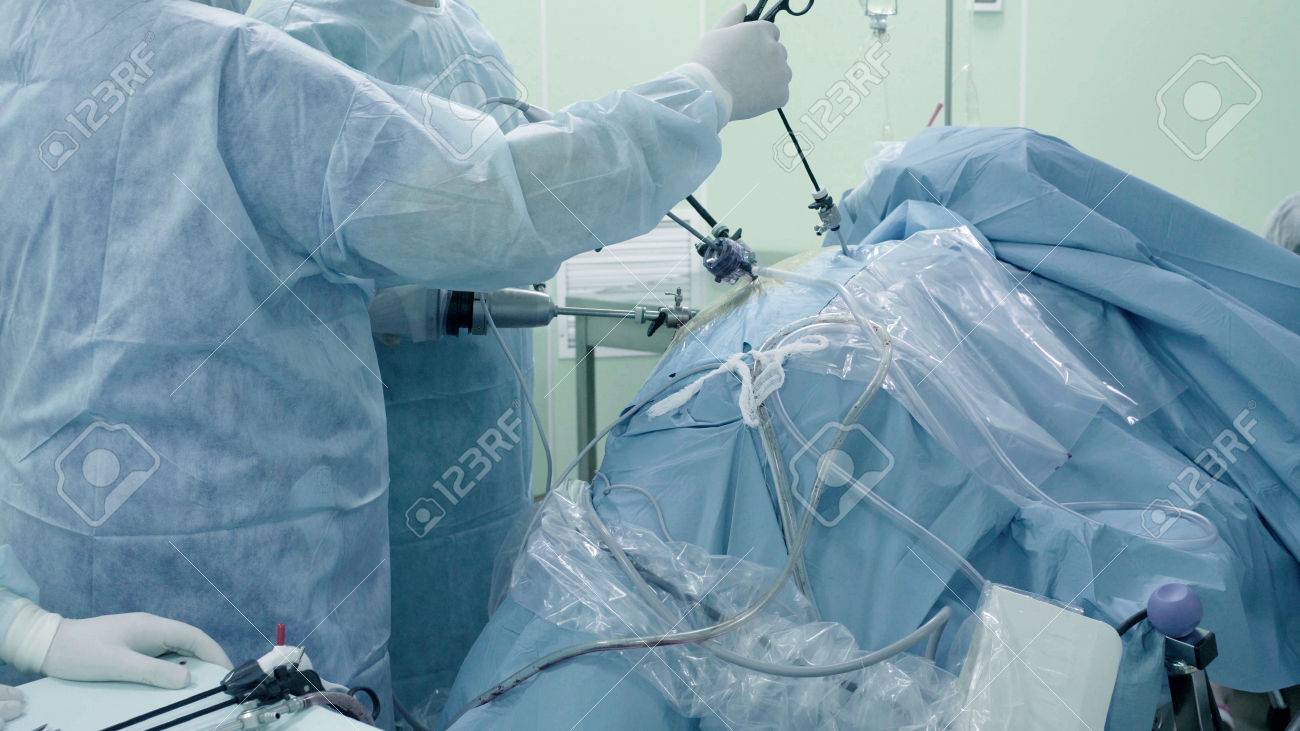 When laparoscopy is used