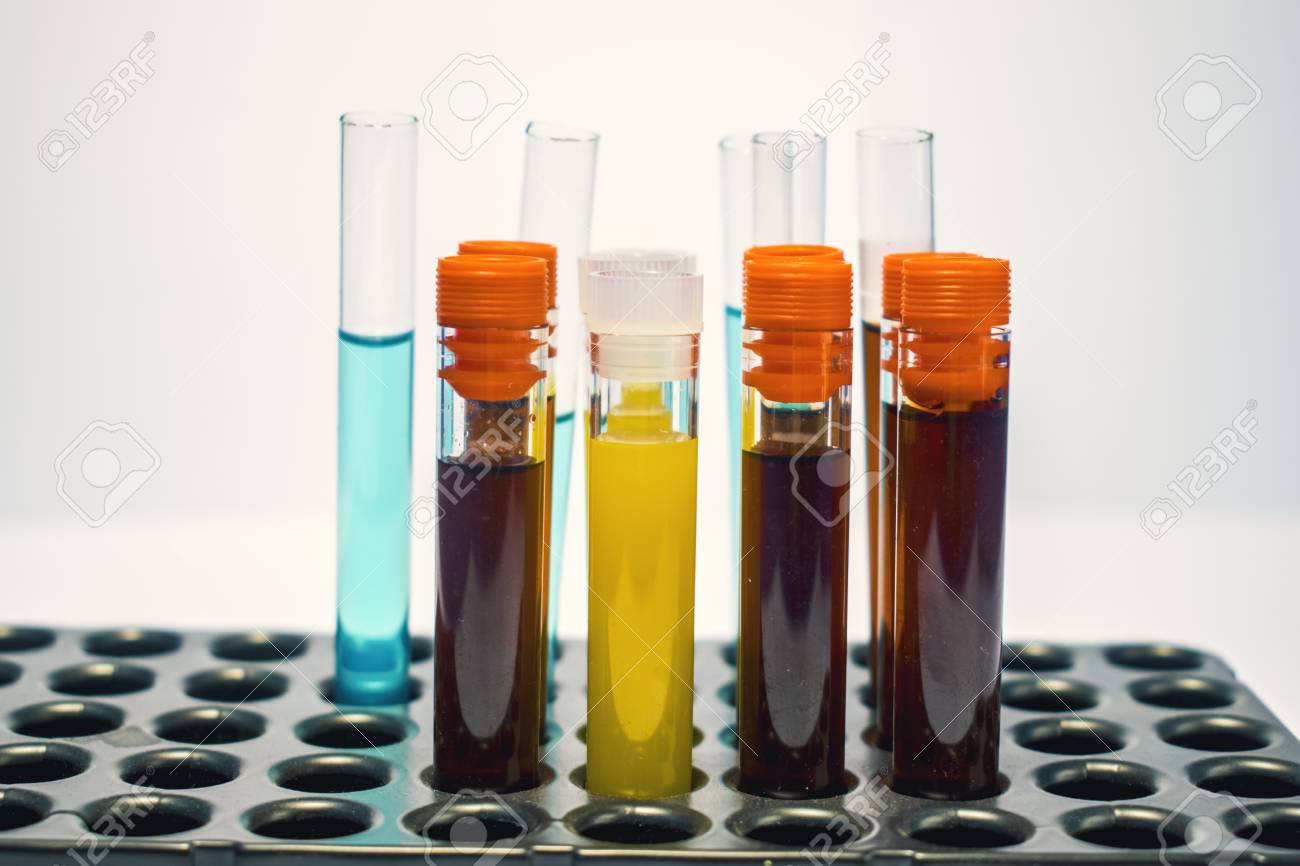 Tubos De Ensayo De Laboratorio Coloridos Análisis De Sangre De Bioquímica Análisis De Orina Tubo De Ensayo Análisis Médico Concepto De Investigación Investigación De Fertilidad Fluidos De Células Madre Fotos Retratos Imágenes