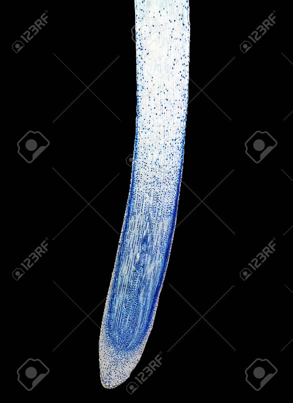 顕微鏡を通して見たタマネギ根端細胞の有糸分裂の軽い顕微鏡写真 の写真素材 画像素材 Image