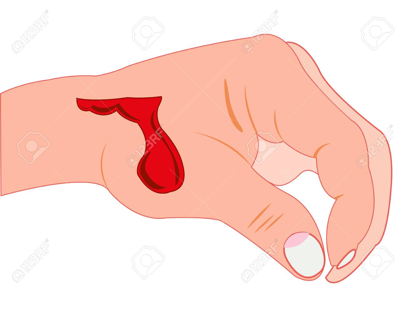 Wound on hand of the person on white background is insulated - 127129386 Wound on hand of the person on white background is insulated - 127129386