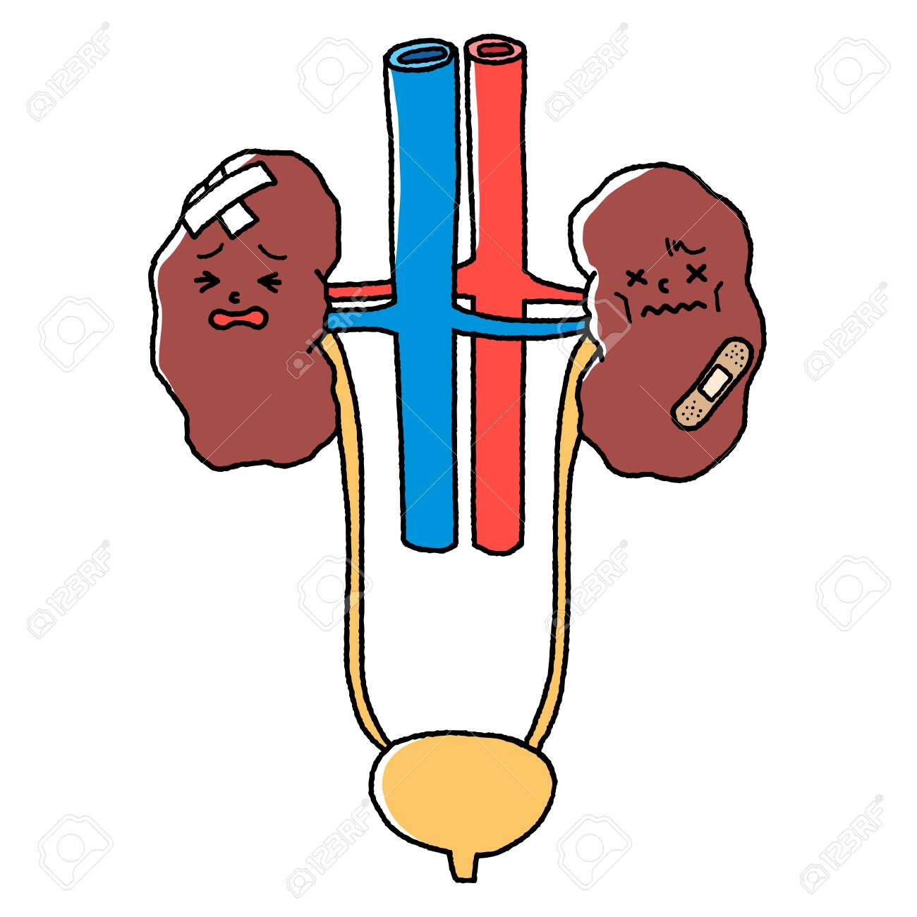 Illustration Of An Unhealthy Kidney Mascot And Bladder, Renal Failure  Royalty Free SVG, Cliparts, Vectors, and Stock Illustration. Image  151167051., image size:1300x1300