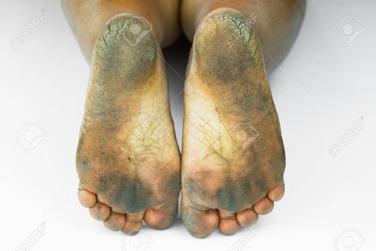 dirty feet in heels Dirty Foot Or Cracked Heels Isolate On White Background, Medical Or Feet  Health Of The People, Medical Center For Heels Or Feet. Stock Photo,  Picture and Royalty Free Image. Image 55156253.