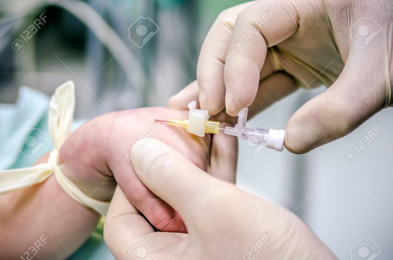 手術前に患者に末梢カテーテルの麻酔科医を設定します 医師の手は ラテックス医療用手袋を保護します の写真素材 画像素材 Image