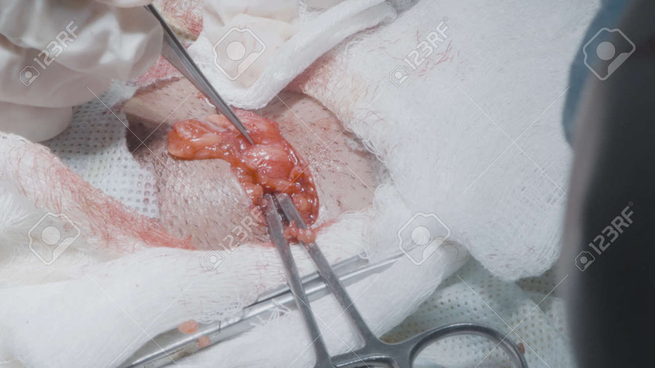 Open skin incision during surgery. Action. Surgeons cut and remove tumor of organ. Operation with open cut and meat outwards. Professional surgery with incisions in flesh - 169163209 Open skin incision during surgery. Action. Surgeons cut and remove tumor of organ. Operation with open cut and meat outwards. Professional surgery with incisions in flesh - 169163209