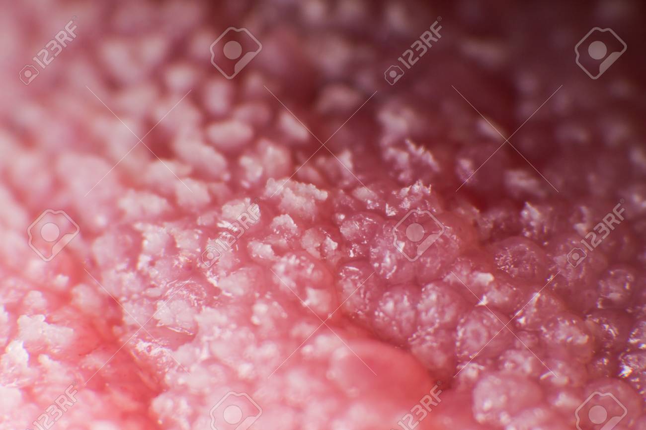 Super Macro Surface Of Tongue Candidiasis Overgrowth Stock Photo Picture And Royalty Free Image Image 120520857