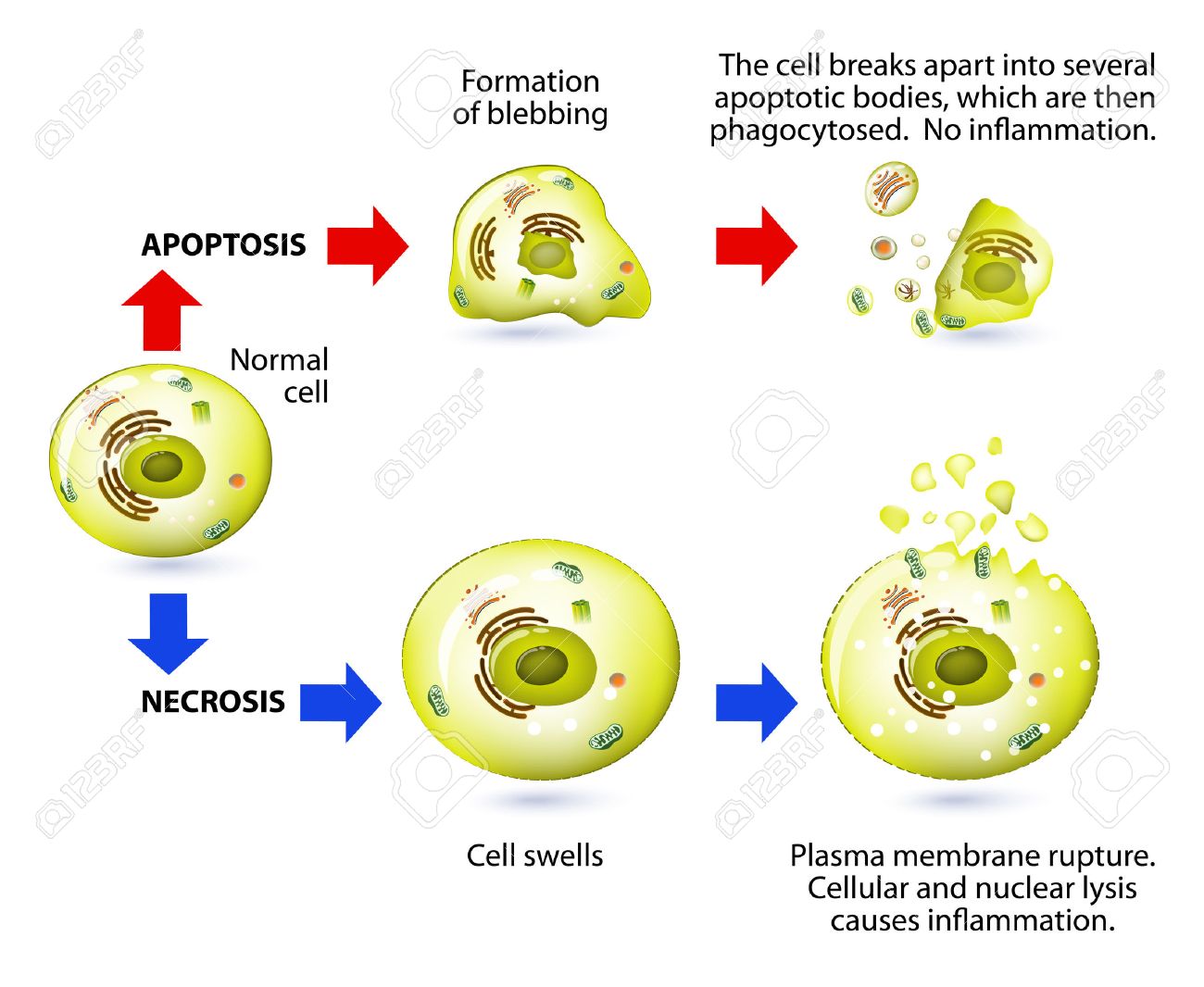 壊死の形態対アポトーシス。アポトーシスと壊死は細胞死の形式です