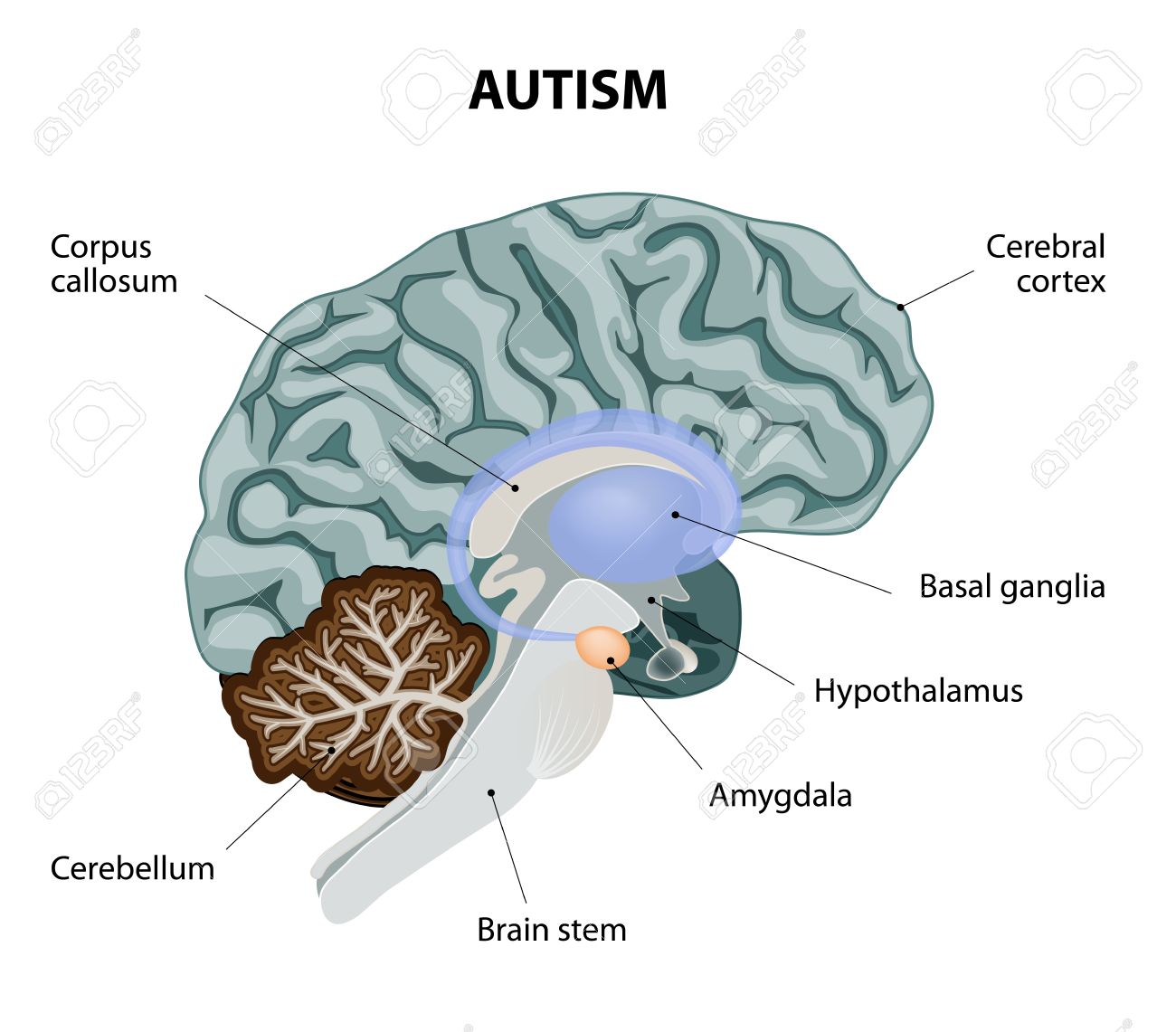 autism diagram wiring diagram autism venn diagram
