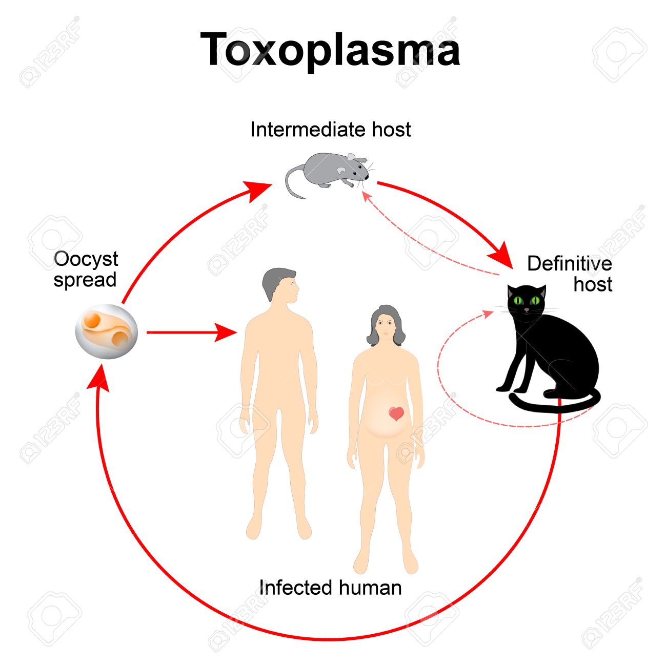 toxoplasmosis gondii gatos