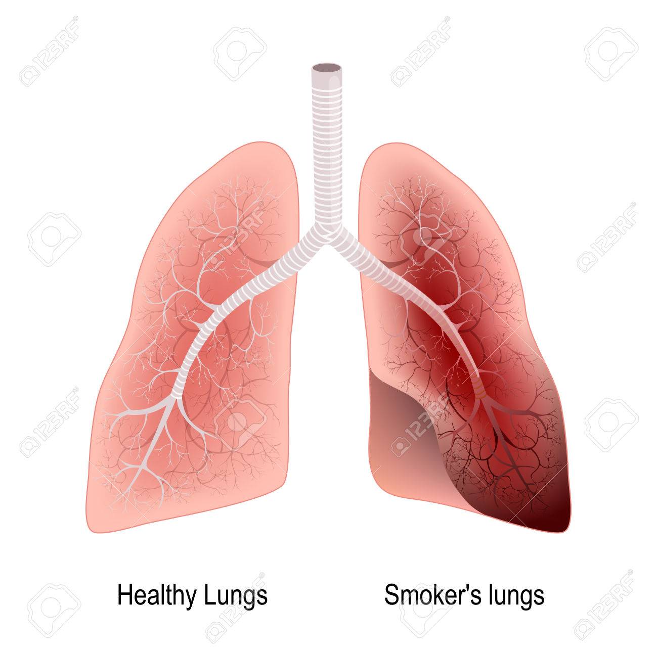 lungs after smoking kordur moorddiner co