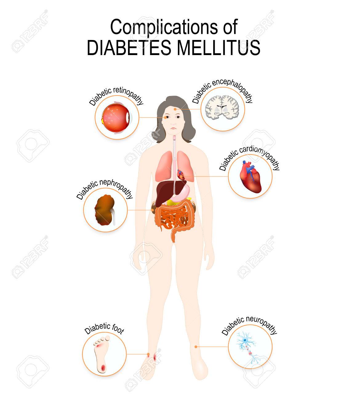 ayuda a los órganos afectados de diabetes