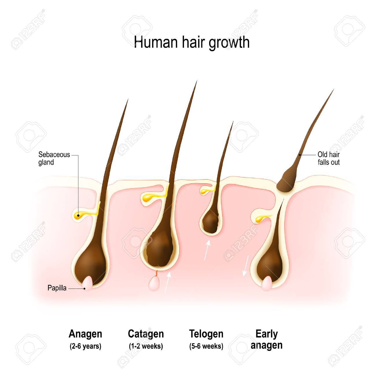 Hair growth. anagen is the growth phase; catagen is the regressing phase; and telogen, the resting phase. Vector diagram - 89044670 Hair growth. anagen is the growth phase; catagen is the regressing phase; and telogen, the resting phase. Vector diagram - 89044670