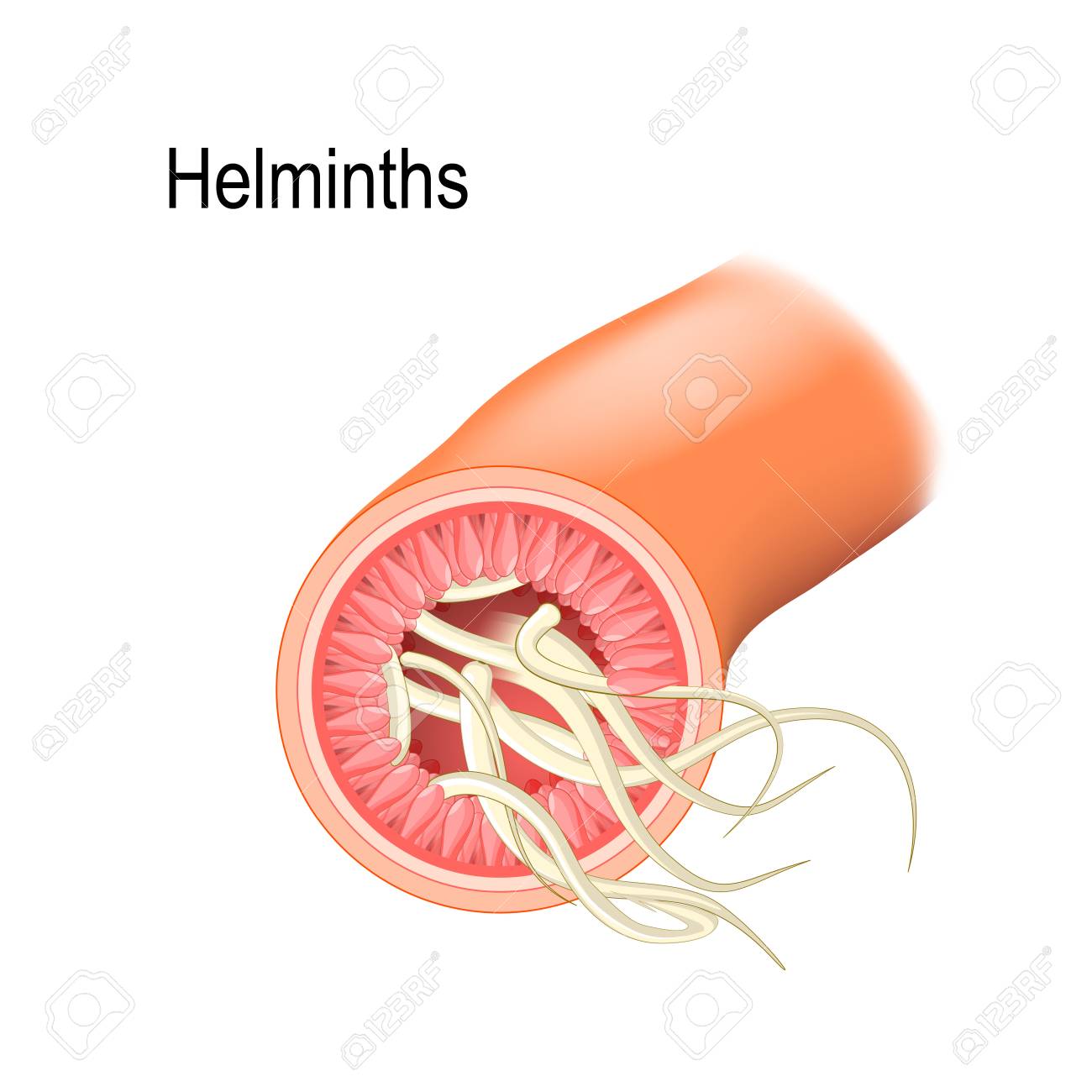 platyhelminthes ppt