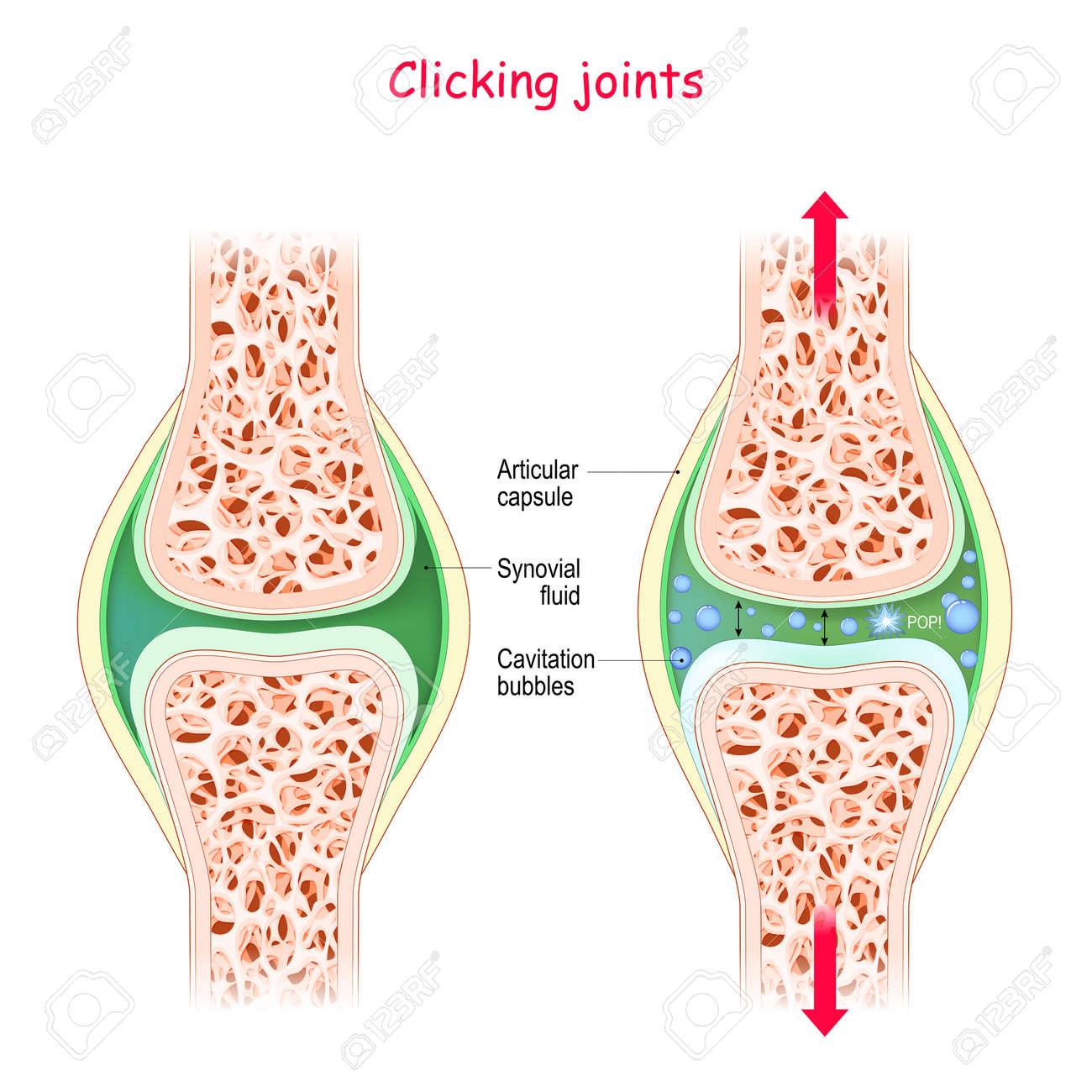 https://previews.123rf.com/images/designua/designua2010/designua201000013/157435466-joints-and-popping-sound-physiological-mechanism-of-cavitation-manipulate-the-joint-we-will-get.jpg