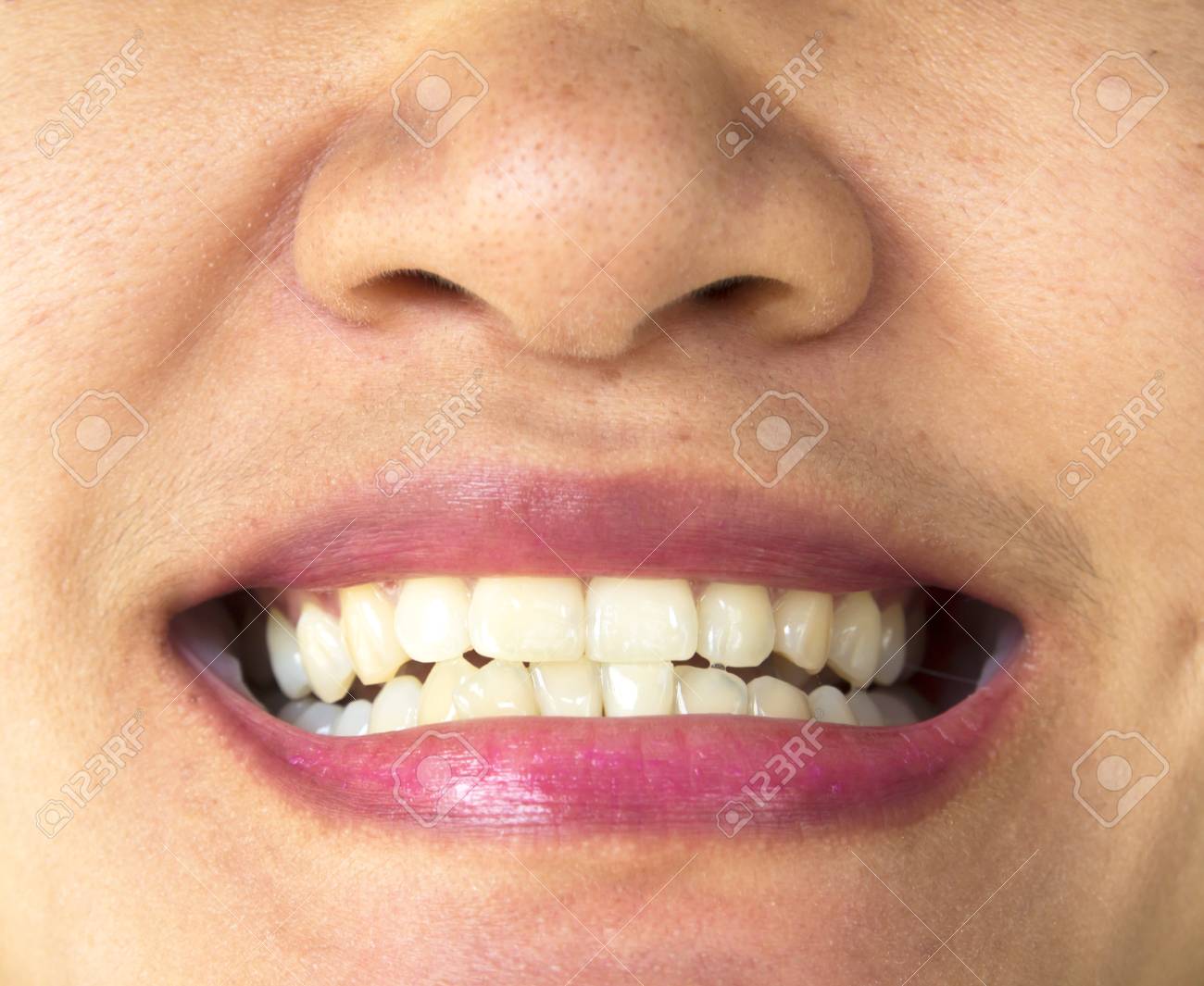 etiam-dictum-ipsum-a-felis