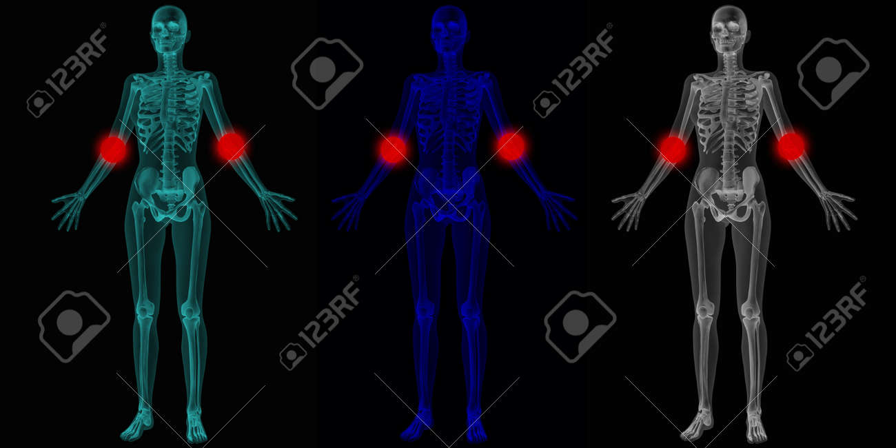 関節の問題の提案と人体解剖学ボディ の写真素材 画像素材 Image