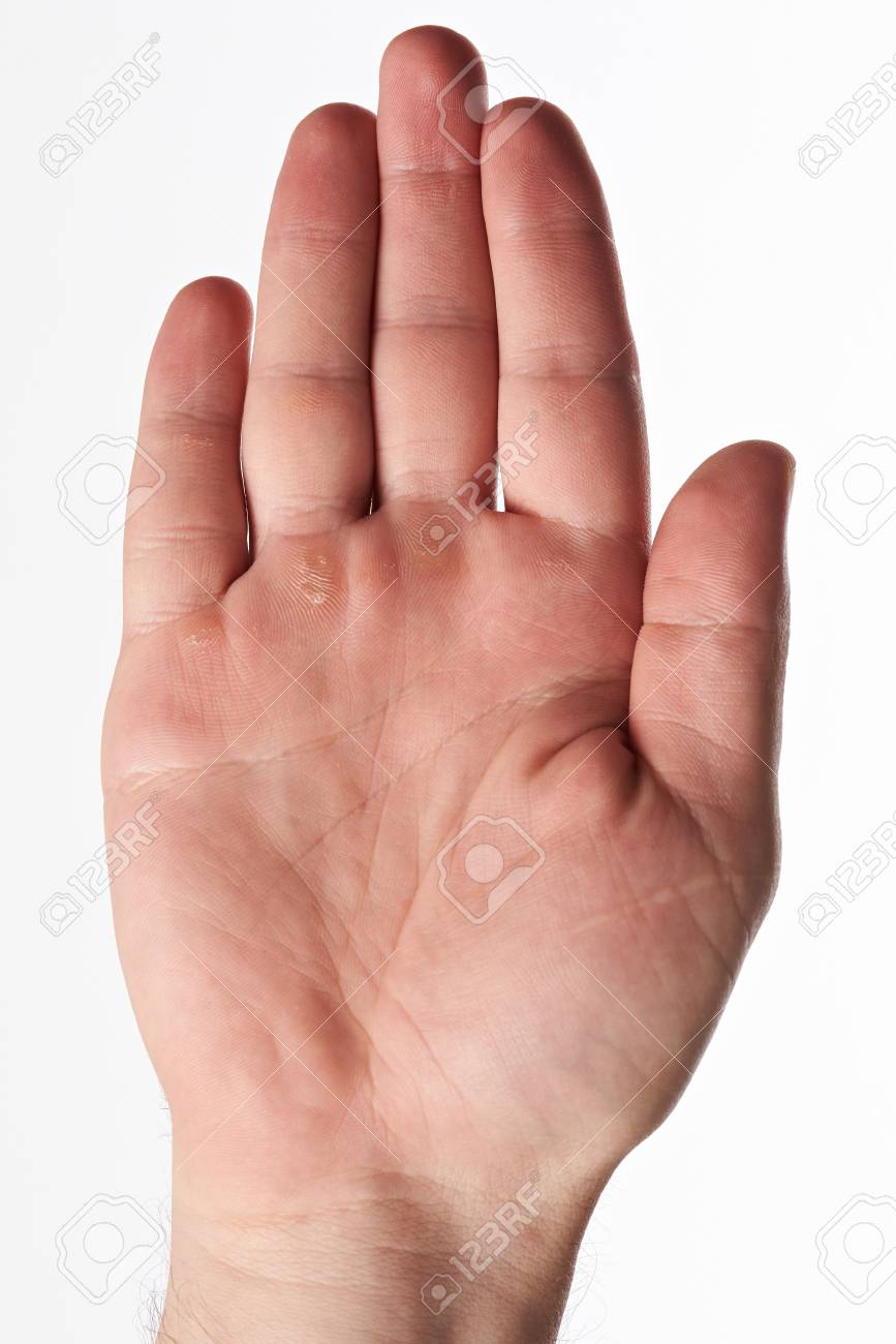 One Hand Palm Of Worker With Callus Isolated On White Background
